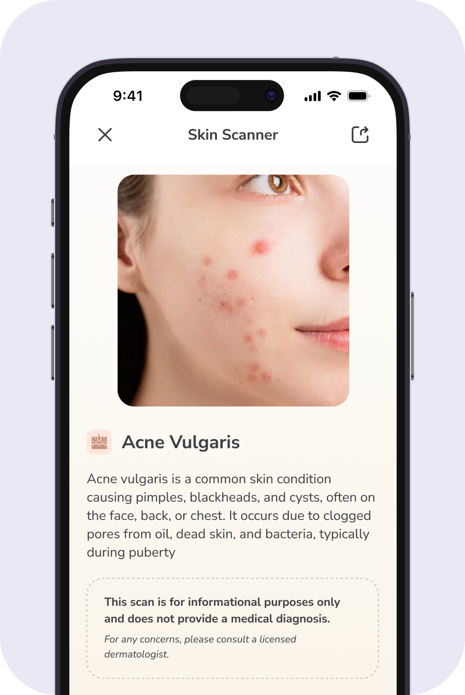 Skin Scanner result inside the AI Beauty Lab app